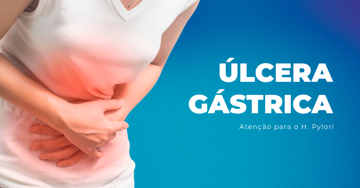 Úlcera Gástrica: entenda como surge, os riscos e a atenção para a bactéria H.Pylori